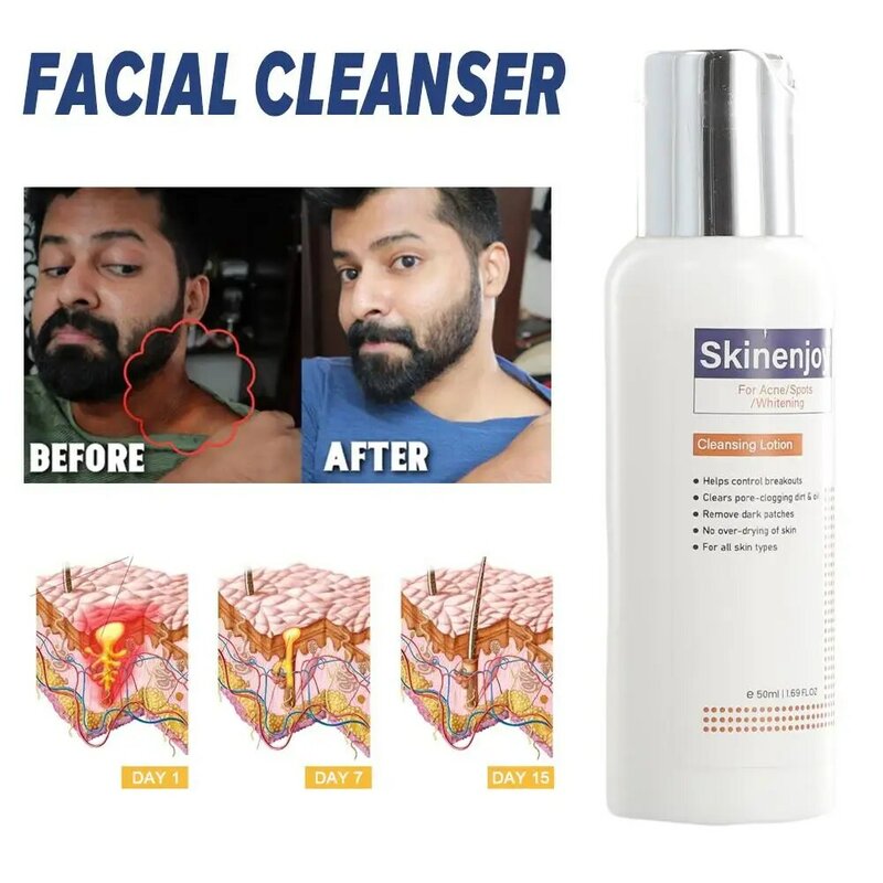 50ml Gesichts reiniger Schaum Gesichts wäsche entfernen Mitesser feuchtigkeit spendende Schrumpf poren Tiefen reinigung Öl kontrolle Bleaching Hautpflege