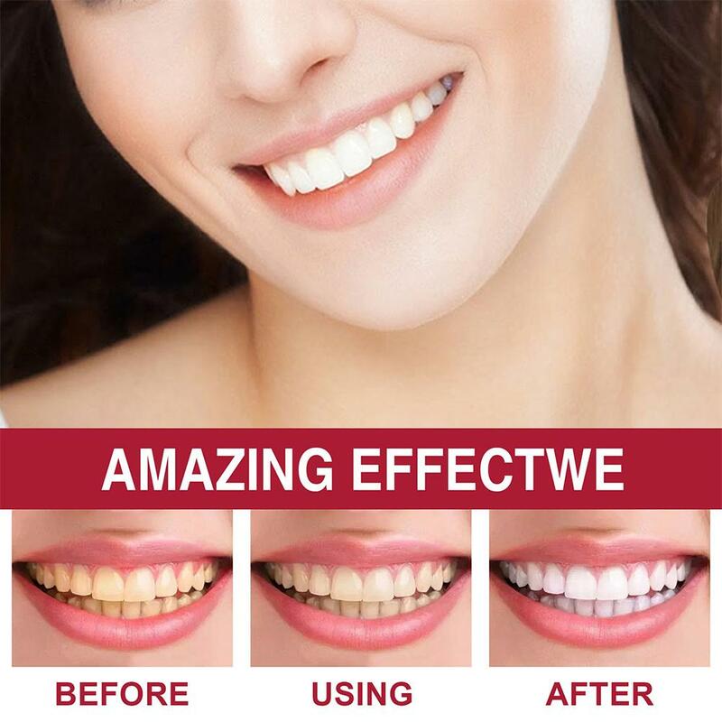 ALL SMILES -BRIGHTENING Stain Removing Probiotic Toothpaste Whitening Toothpaste Cavity Prevention Teeth Whitening Paste New
