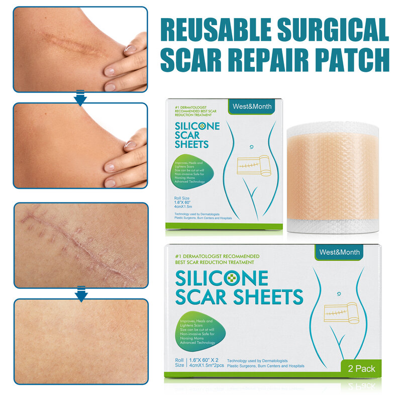 Folhas de remoção de cicatriz de silicone, Skin Repair Patch, fita autoadesiva Stretch Mark, terapia Patch, cuidados com acne, 300cm
