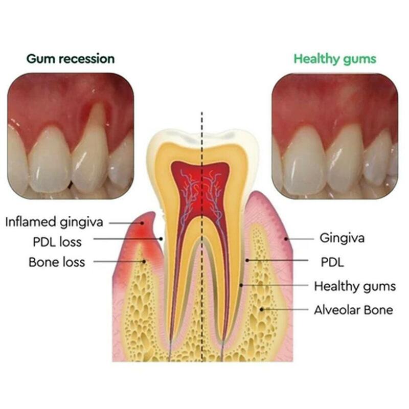 30ml Gum Care Products Liquid Gum Repair Gum Regrowth Natural Oral Care Drops Gum Restore Oral Gum Care Liquid For Oral Car P2R0