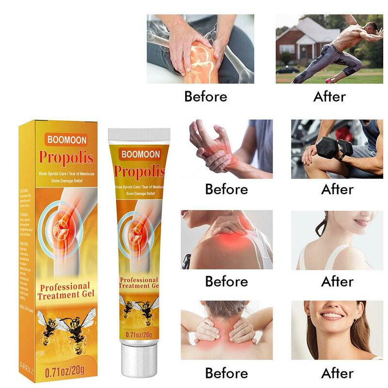 Professional Bee Bone Therapy Cream 20g Advanced Bee Gel Joint And Bone Therapy Effective Therapys For Legs Hands Arms Feet