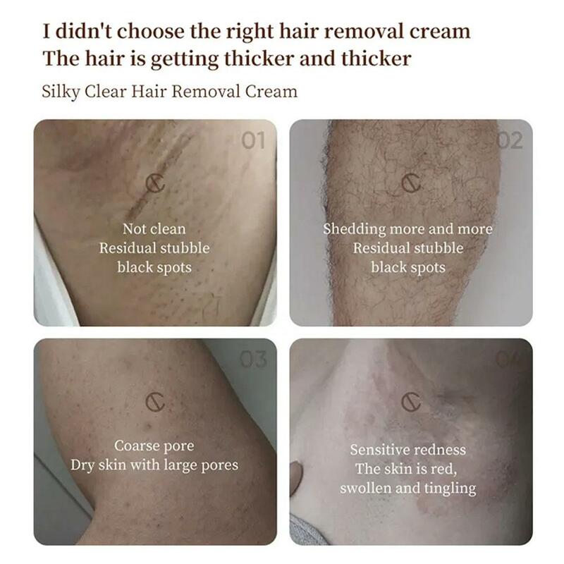 150g Sensitive Skin Hair Removal Cream For Women Men, Painless Bikini Hair Remover Gel, Depilatory Cream For Intimate Areas L2M3