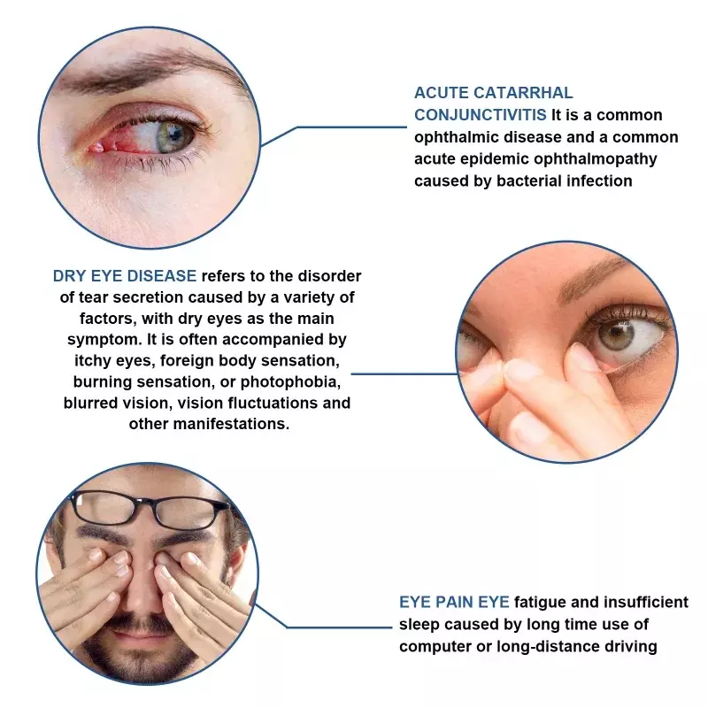 Крем для ухода за глазами восстанавливает боль в глазах красная кровь мазь для сухой усталости глаз защита зрения миопия увлажняющий пластырь для здоровья