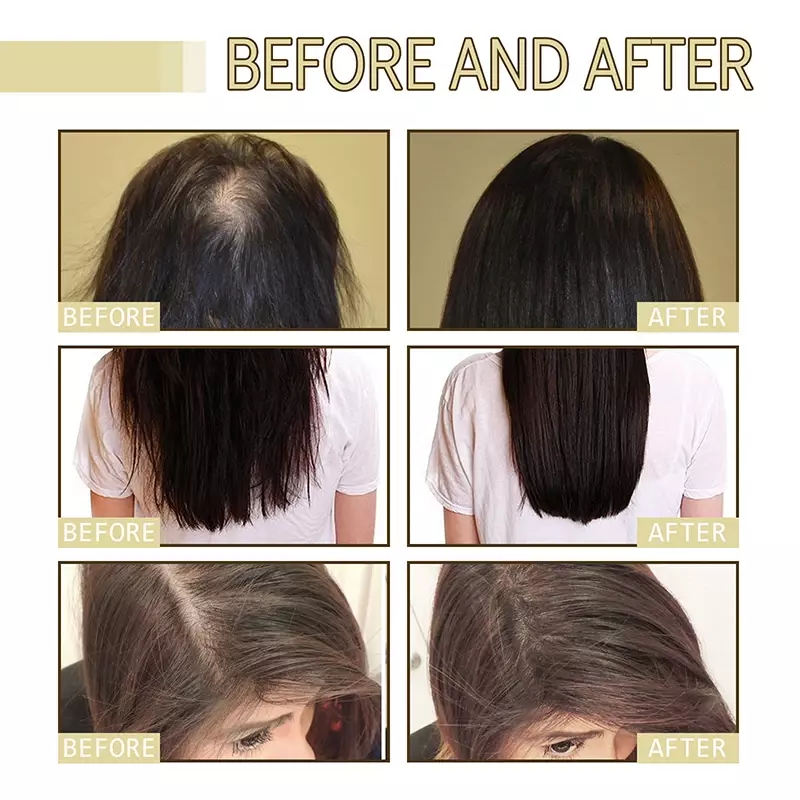 Эфирное масло для густых волос EELHOE, восстанавливает повреждение волос, предотвращает выпадение волос, смягчает и питает волосы, масло-эссенция
