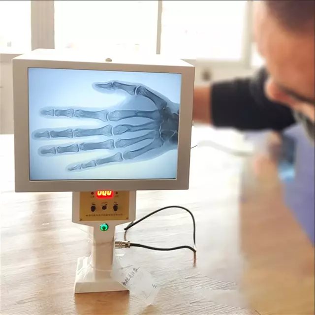 Máquina de fluoroscopio de mano, instrumento de rayos x portátil, equipo de diagnóstico de rayos X más pequeño, precio