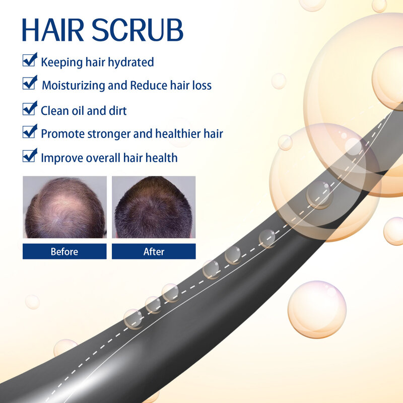 Champú para el tratamiento de la pérdida de cabello, limpieza antipicazón, eliminación de la caspa, daño nutritivo, reparación de la calvicie del folículo, Exfoliante para el crecimiento del cabello
