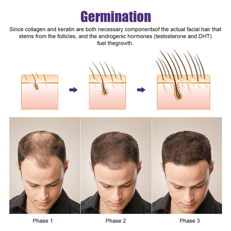 Derma Professional Microneedling Face Massage Roller per la crescita della barba del viso crescita dei capelli 0.2/0.25/0.3mm sistema di mesoterapia bellezza