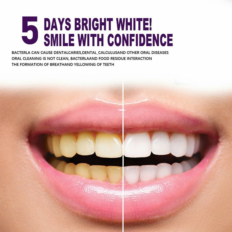 Dentes Whitening Pen, Soro de limpeza, Remover manchas de placa, Dentes branqueamento Gel, Higiene Oral, Odontologia Ferramenta, 3ml
