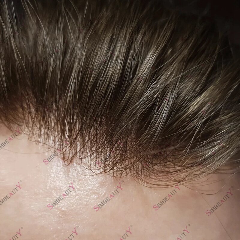 Piel ultrafina de 0,02-0,03mm, micropiel, cabello humano, tupé indetectable, prótesis de línea de cabello Natural, sistema capilar