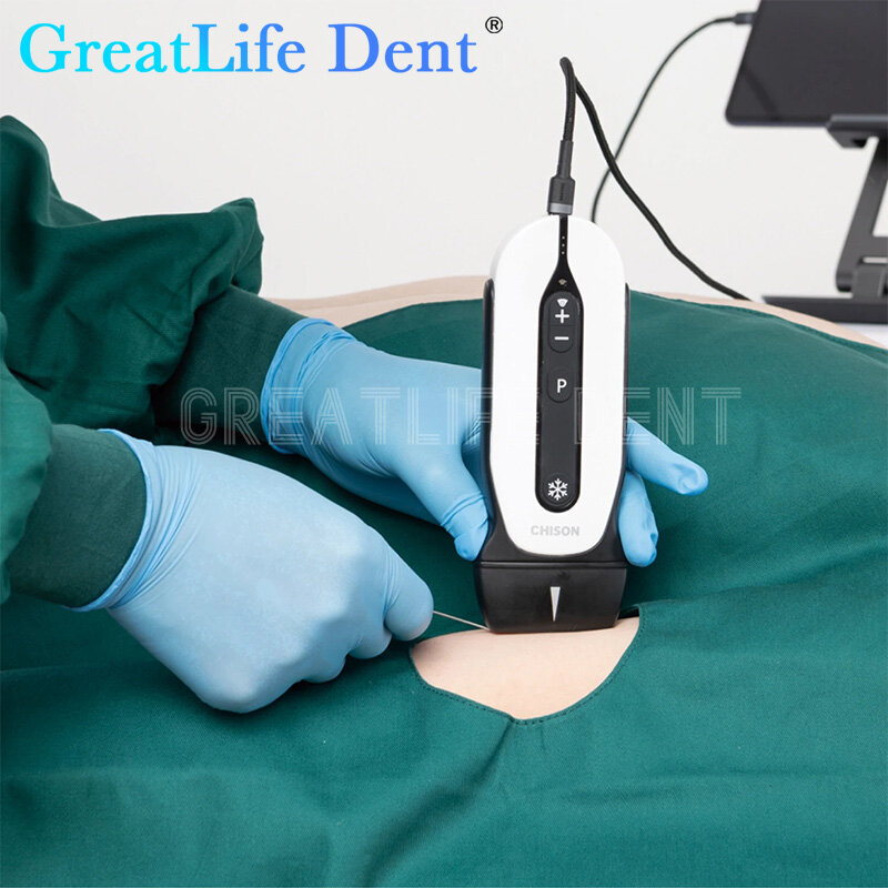 GreatLife-portátil Cardíaca Micro-Convexa Handheld Ultrasound Scanning Machine, Dent SonoEye, P1, P2, P3, P5, P6, Sistema de Exame Digital