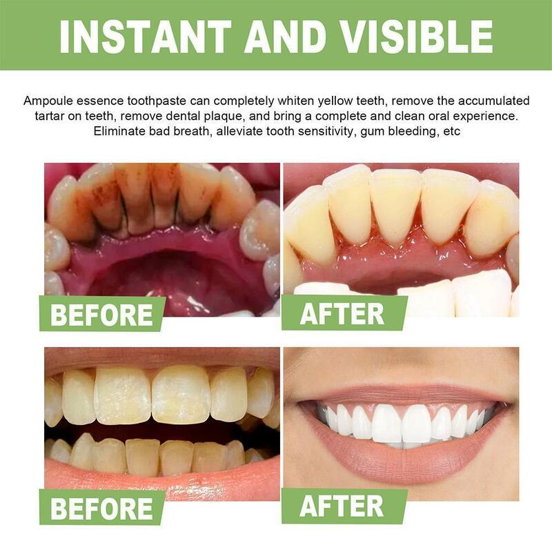 เซรั่มฟอกสีฟันรสมิ้นท์ธรรมชาติบำรุงช่องปากกำจัดคราบยาสีฟันที่มีประสิทธิภาพขนาด15มล. E4N0