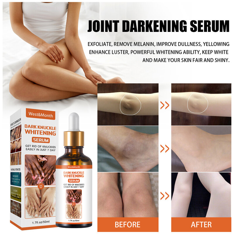 Acanthosis Nigricans Therapy Oil Joint De-blackening Serum  Lighten Melanin Dark Spots Cream Whitening Knee Ankle Corner Armpit