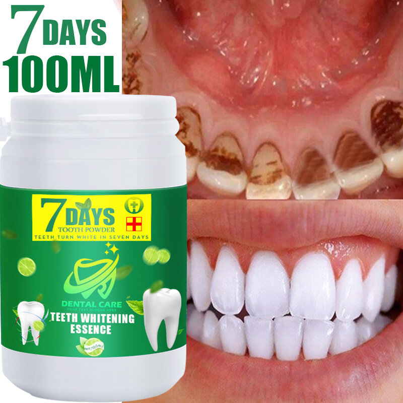 120 مللي تبييض الأسنان مسحوق إزالة البلاك البقع معجون الأسنان الطازجة التنفس نظافة الفم عن طريق الخطأ أدوات العناية بالأسنان