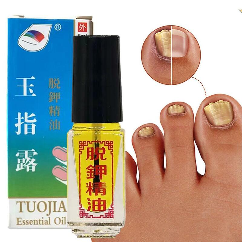 1/3/5pcs 5ml Tuojia Essential Oil Removal Of Onychomycosis Care Fungal Nail Toe Oil Infection Anti Paronychia Oil Nail Fungus