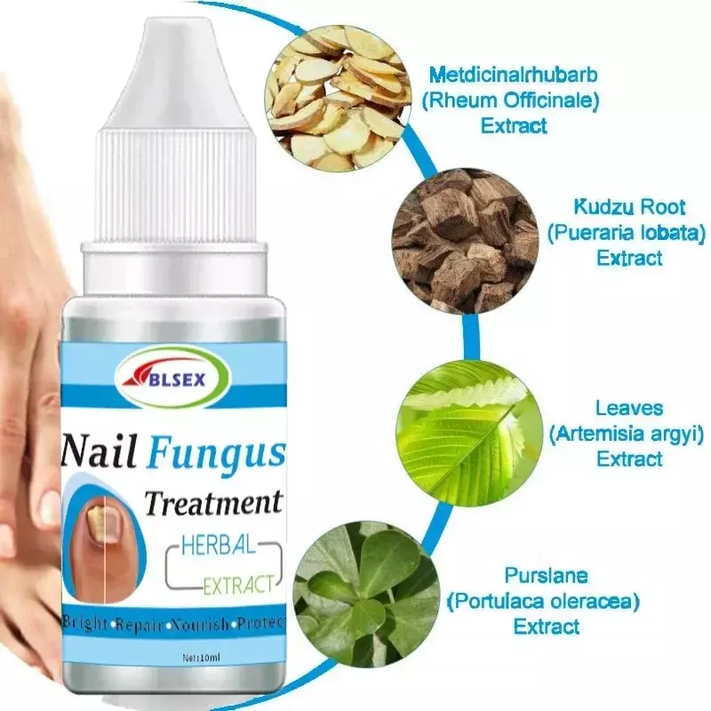 Nail Repair Solution Fungus Nails Treatment For Fingernails Toenails Repair Onychomycosis Paronychia Anti Infection Toe Nail New