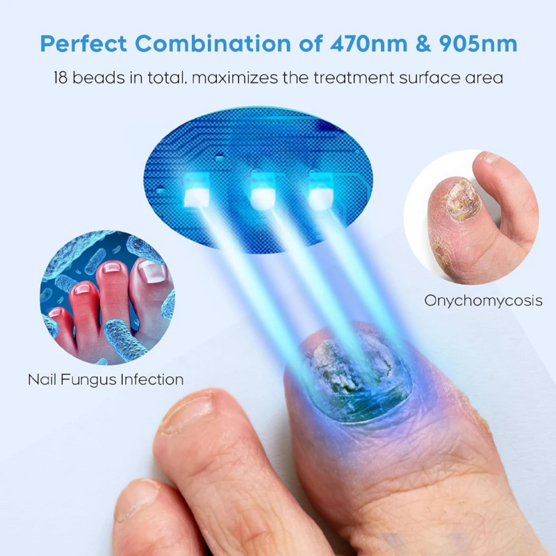 Средство для удаления грибковых ногтей, лазерный прибор для восстановления быстрого грибка ногтей, онихомикоза, антитиреоит, натуральное чистое масло, уход за ногами, красота, здоровье