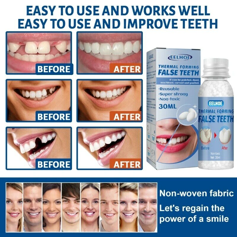 Resina 10g/20g/30g reparação temporária dentes lacunas dentes dentes falsos cola sólida dentadura adesiva dentes