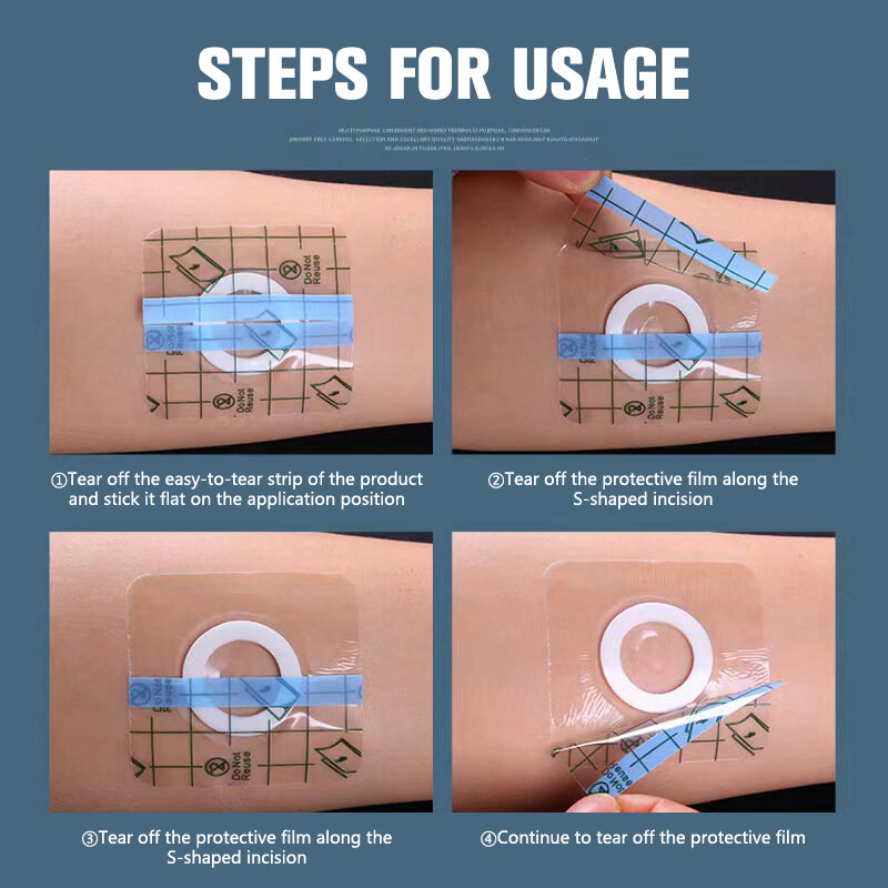 10Pcs Waterproof Anti-allergic Medicinal Wound Dressing Fixation Tape Navel Medical Transparent Tape PU Film Adhesive Plaster