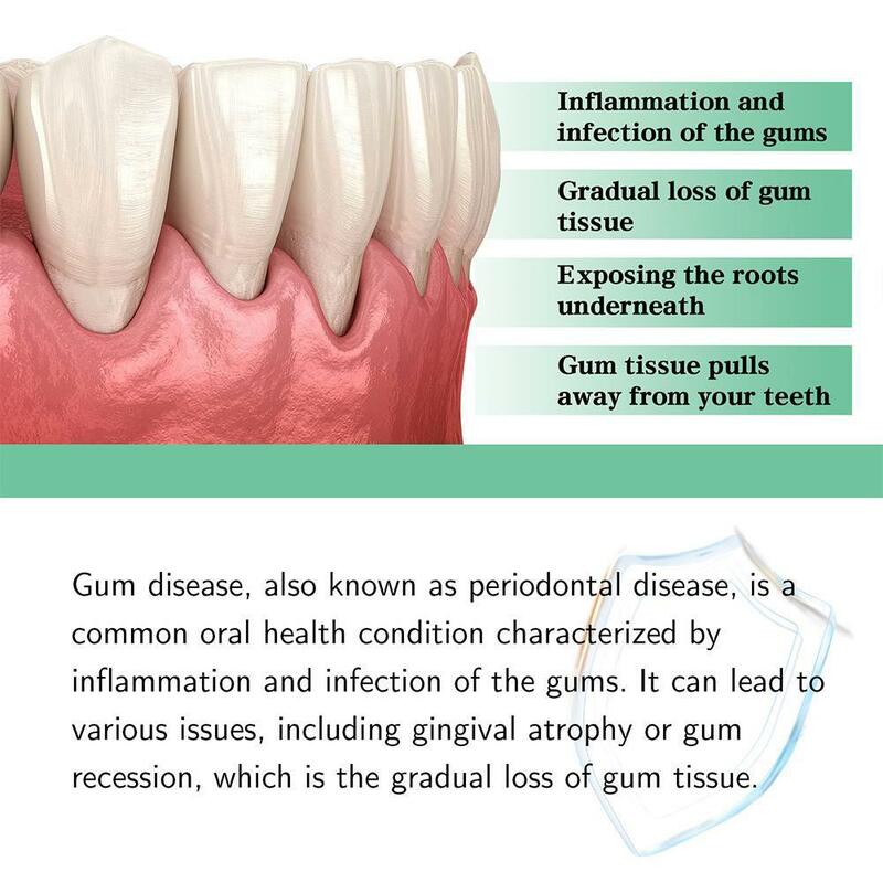 Gum Repair Serum Drops Relieve Receding Gum Periodontal Yellow Blistering Whiten Teeth Toothache Toothpaste Care Remove U7I1