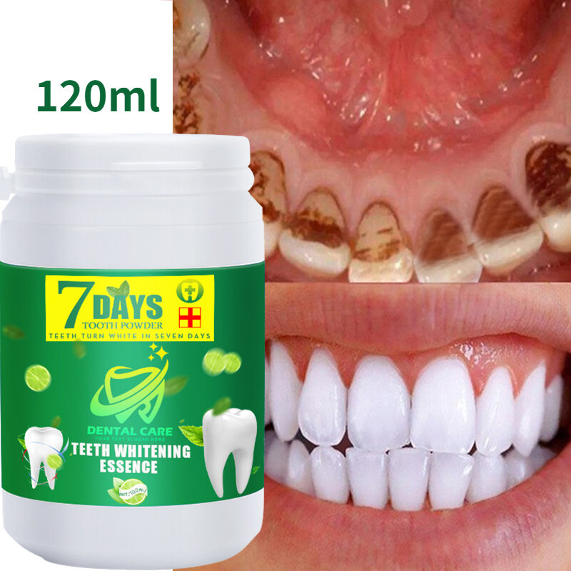120ml Zahnweiß pulver entfernen Plaque Flecken Zahnpasta frischen Atem Mundhygiene geistig Werkzeuge Zahnpflege Zahnstein entfernen