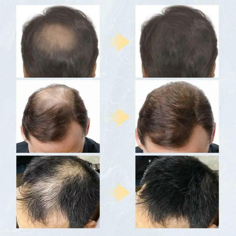 Toppik-fibras de queratina para el cabello, polvos de crecimiento instantáneo, corrector para la pérdida de cabello, 27,5g