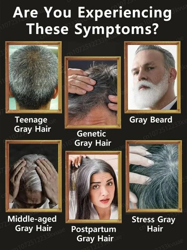 Killer per capelli bianchi, rimuovi i capelli grigi e ripristina il colore naturale dei capelli in 7 giorni