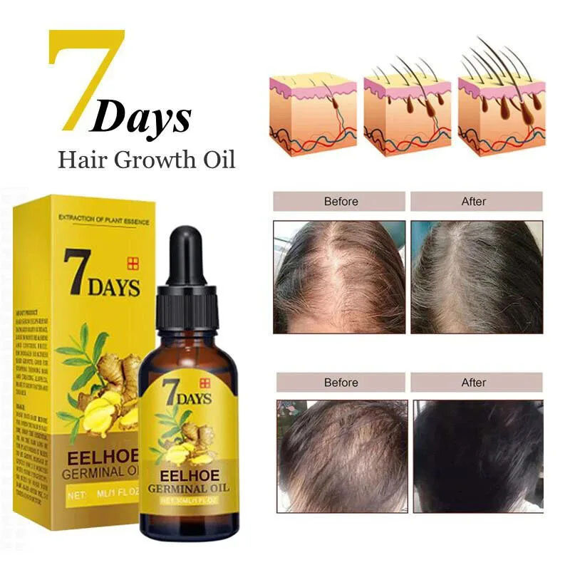 Suero rápido para el crecimiento del cabello para mujeres y hombres, aceite esencial anticaída para el crecimiento del cabello, reparación de raíces dañadas, cuidado del cabello, 7 días