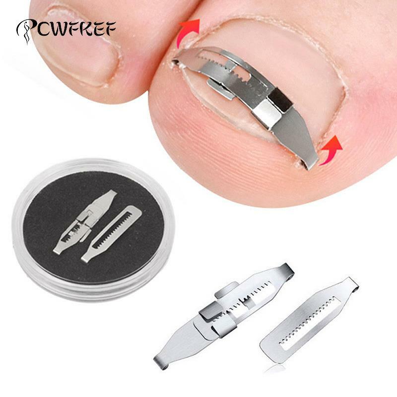 Wrastający paznokieć korektor narzędzia Pedicure odzyskaj osadzić Toe terapia na paznokcie profesjonalne narzędzie do korekcji stóp pielęgnacja stóp