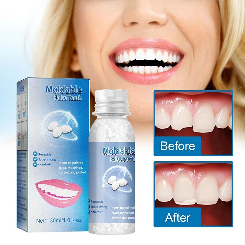 Gigi palsu lem padat temporer plastik, gigi tiruan, perekat perawatan gigi tiruan