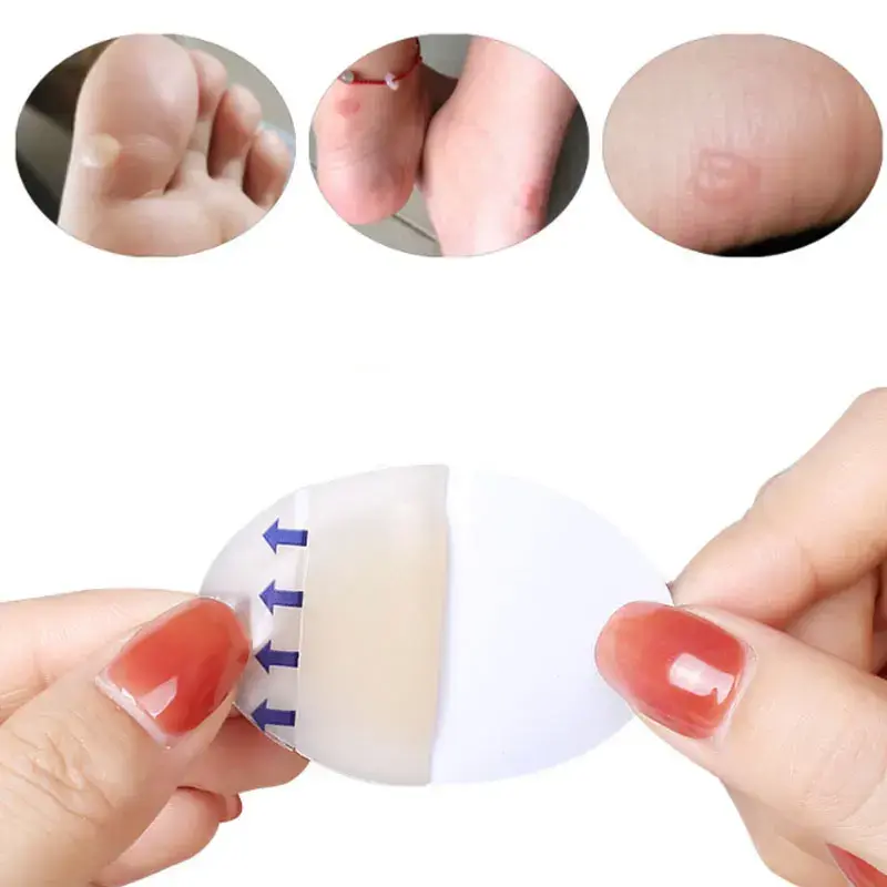 10PCS Soft Gel Shoes Sticker Hydrocolloid Patch Blister Protector Relief Pain Blisters Bunion Corrector Callus Remover Foot Care