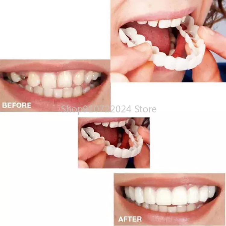 2 Buah/Set Set Gigi Silikon Pemutih Gigi Penutup Kawat Gigi Simulasi Gigi Palsu Gigi Atas Gigi Bawah dengan Kotak Senyum Sempurna
