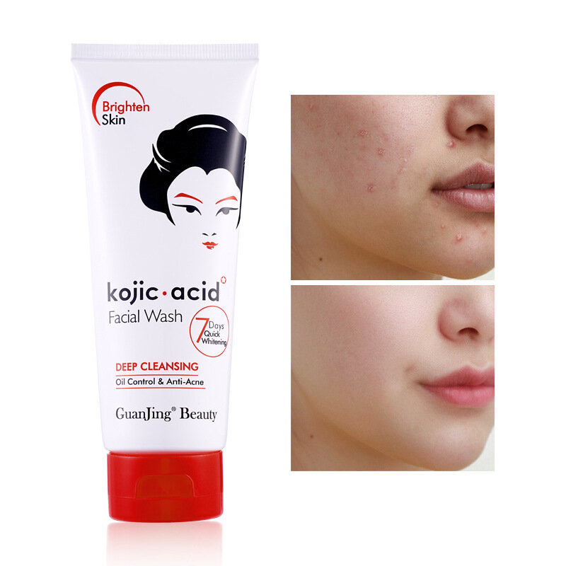 Kojic Acid Face Wash, Deep Cleansing, Anti-Acné Cleansing, Repair Damaged Skin, Beveres Deformles, 100g