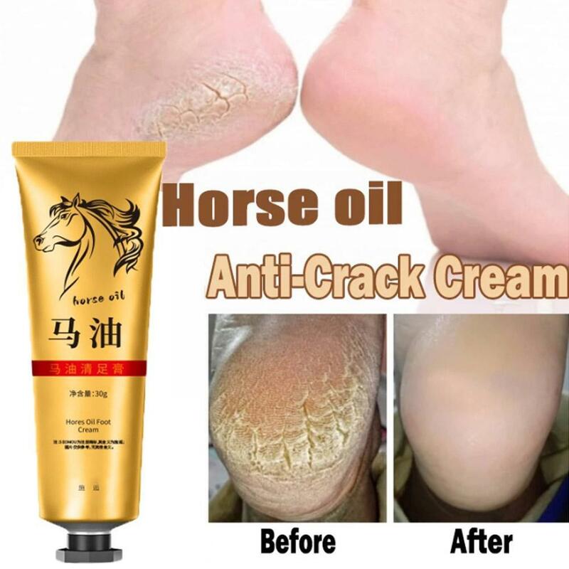 Aceite de caballo para pies, crema reparadora de Peeling, hidratante, suave para manos muertas, eliminación de callos, piel seca, antigrietas, 30g, B7M2