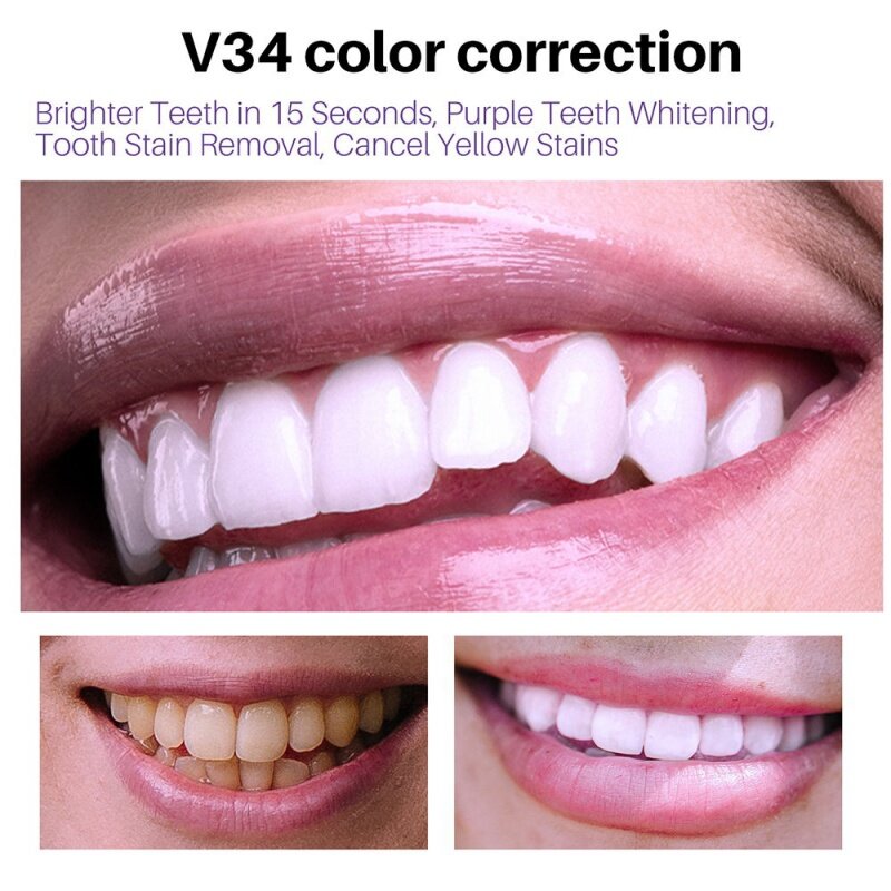 V34 무스 치약 치아 청소 교정기, 치아 미백 브라이트닝, 황변 감소, 치아 청소 케어, 50ml