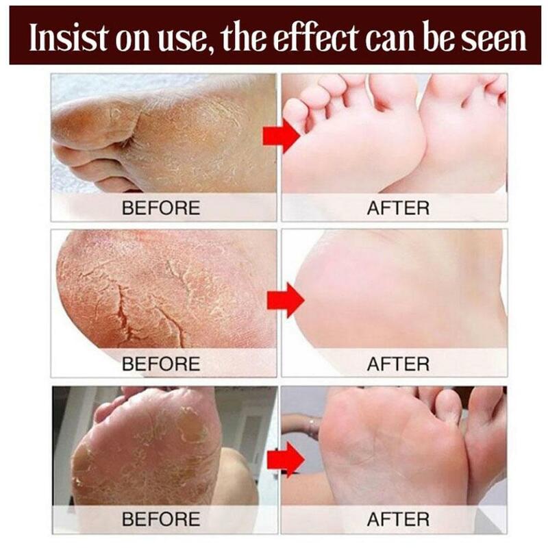 Horse Oil Foot Cream Anti Dry Crack Repair Heel Feet Hand Cracked Exfoliating Feet Moisturizing Foot Nourishing Balm Creams Y6F2