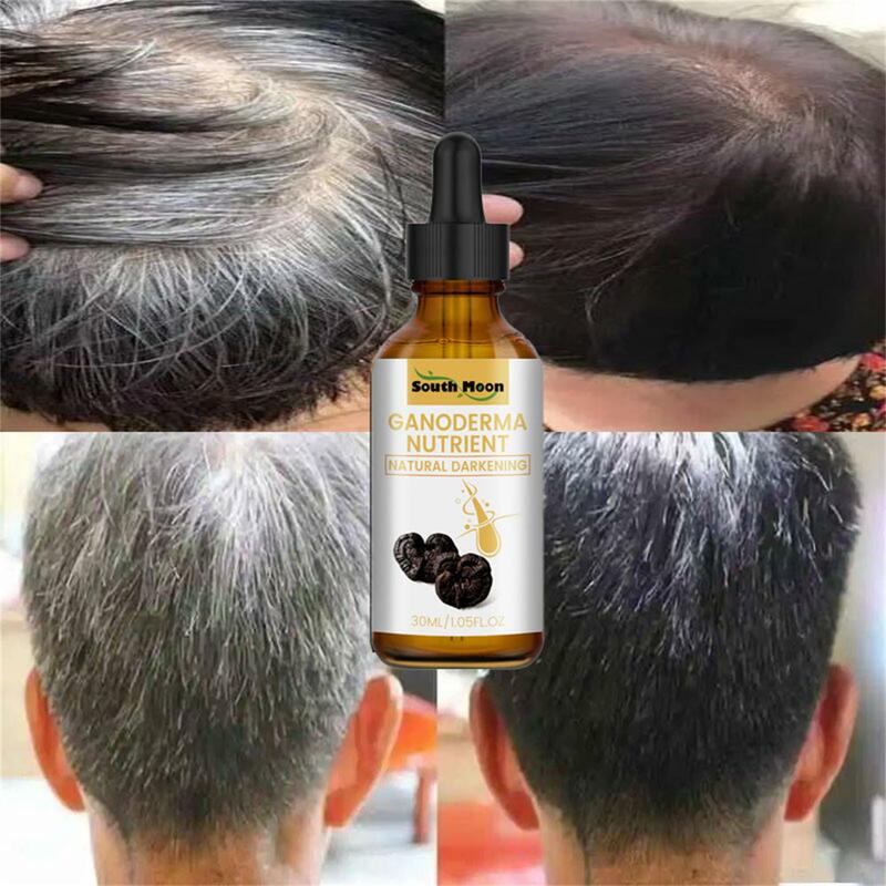 Gray White Hair Treatment Serum Liquid White To Black Natural Color Repair Nourish Products Anti Loss Hair Care for Men Women