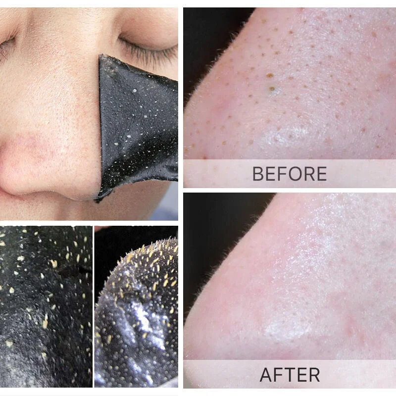 Masque de suppression des points noirs, autocollant antarctique, patch de soins de la peau, nettoyage en profondeur, rétrécissement des pores, traitement
