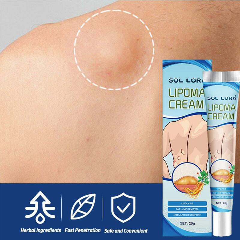 Lipoma Ointment Effectively Removal Lipoma Fibroids Cream Body Cream Dissolving Fat Easy To Use Herbal Lipoma Removal Cream
