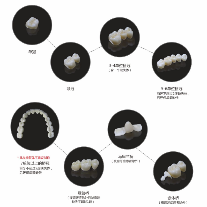 5 warstw Upcera odkrywa funkcjonalny dentystyczny półfabrykat cyrkonu z cyrkonu 98mm naturalny Gradient kolorów dentystyczny wielowarstwowy tlenek cyrkonu