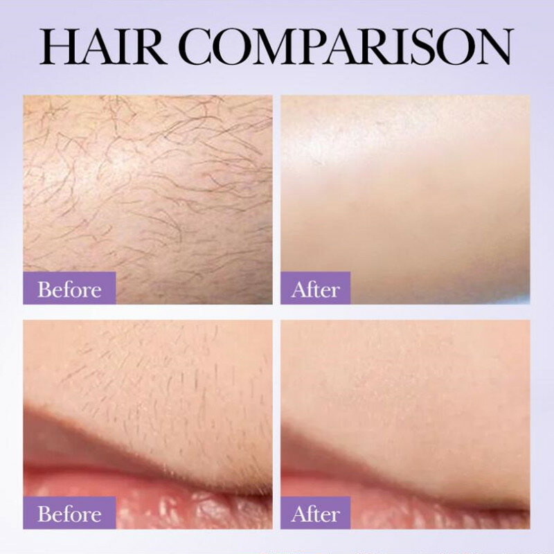 30ml Powerful Permanent Painless Hair Removal Spray Oil Spray Shrink Pores Growth Stop Ant Smooth Skin Inhibitor Hair