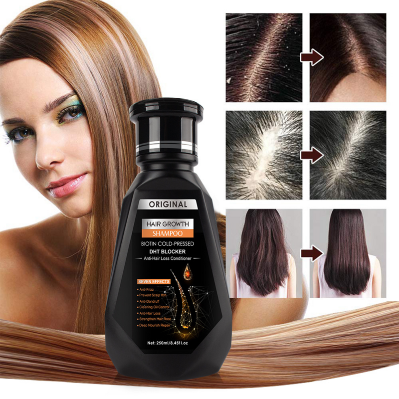 Champú de jengibre para el crecimiento del cabello, biotina prensada en frío, acondicionador anticaída, crema de masaje, tratamiento del cabello, productos para el cuidado del cabello