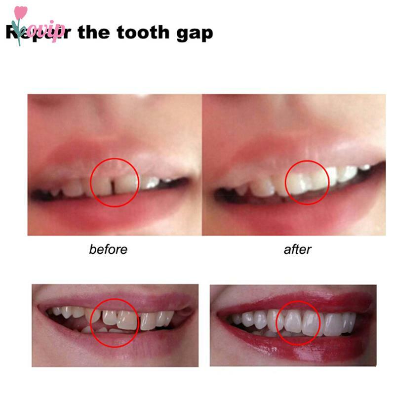 Alat kecantikan gigi, 10g/50g /100 gsementara gigi dan lubang gigi palsu lem padat perekat pemutih gigi