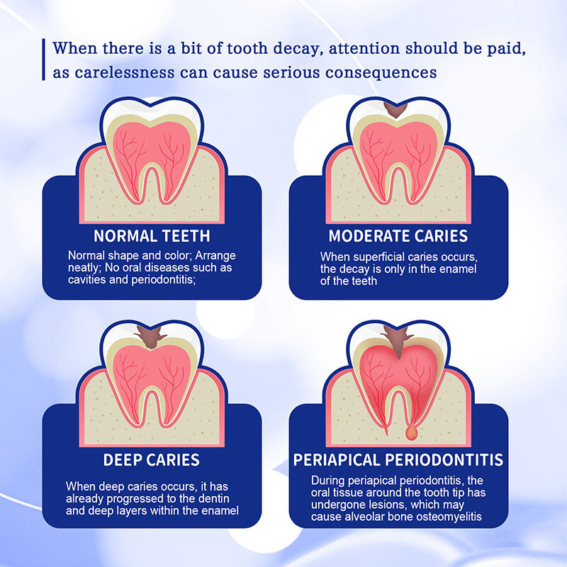 Riparazione della carie dentifricio sbiancante alito cattivo fresco carie Anti-cavità rimuovere la placca mal di denti alleviare la parodontite