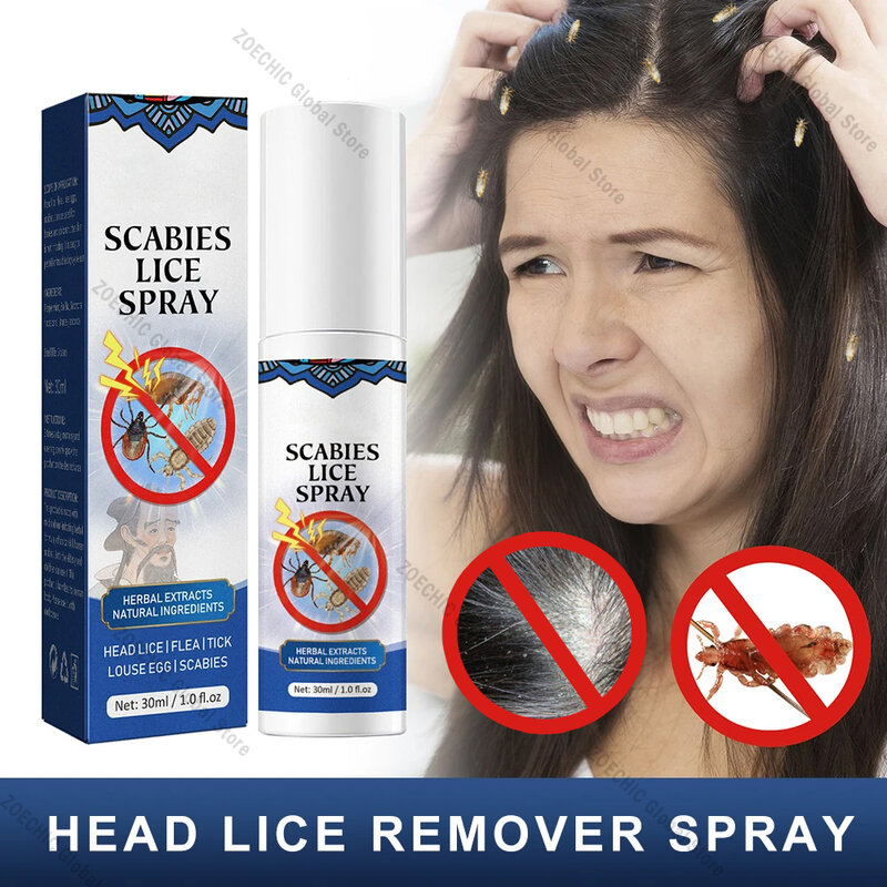 Spray de eliminación de Piojos de cabeza para niños y adultos, eliminación de piojos, huevos, liendres, promueve el cabello sin piojos, elimina pulgas, 30ml