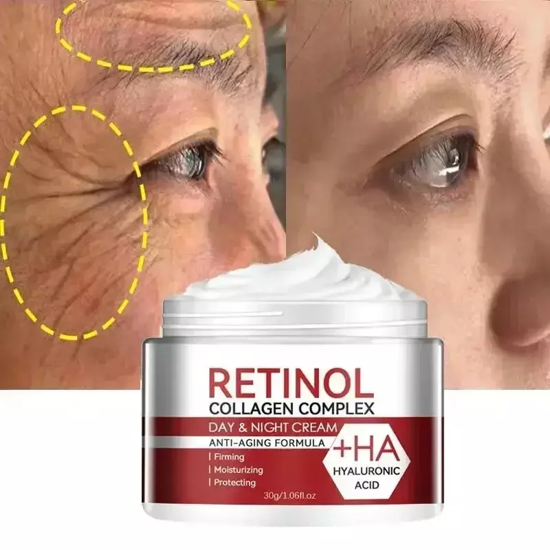 Retinol Falten entfernen Creme Anti-Aging straffen Lifting verblassen feine Linien Bleaching Aufhellung feuchtigkeit spendende Hautpflege Kosmetik