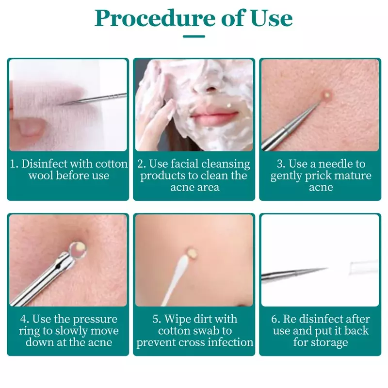 Pinzas de Clip para espinillas y acné, Extractor de manchas de acné, herramienta de belleza para el cuidado de la piel facial