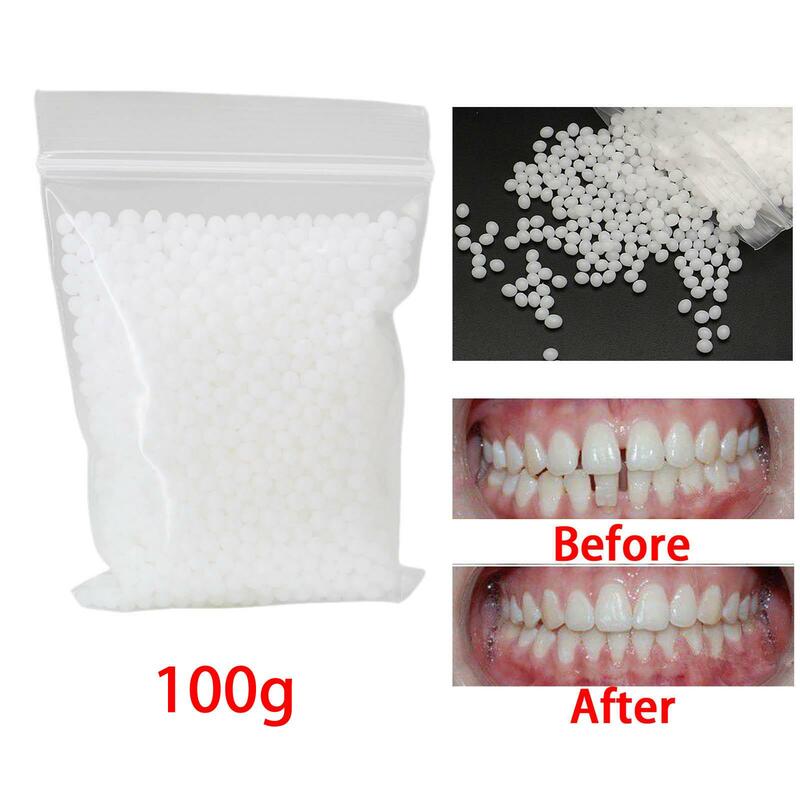 Kit de reparação dentária temporária, prótese adesiva, dentadura moldável, grandes lacunas branqueamento, 100g