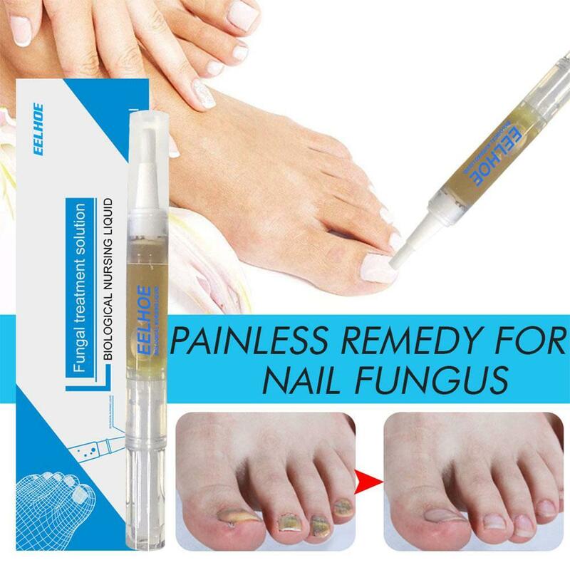Hand Foot Nail Repair Liquid Onychomycosis Fungus Thickening Soft Nail Repair Anti-infection Recovery Nail Health Repair Essence