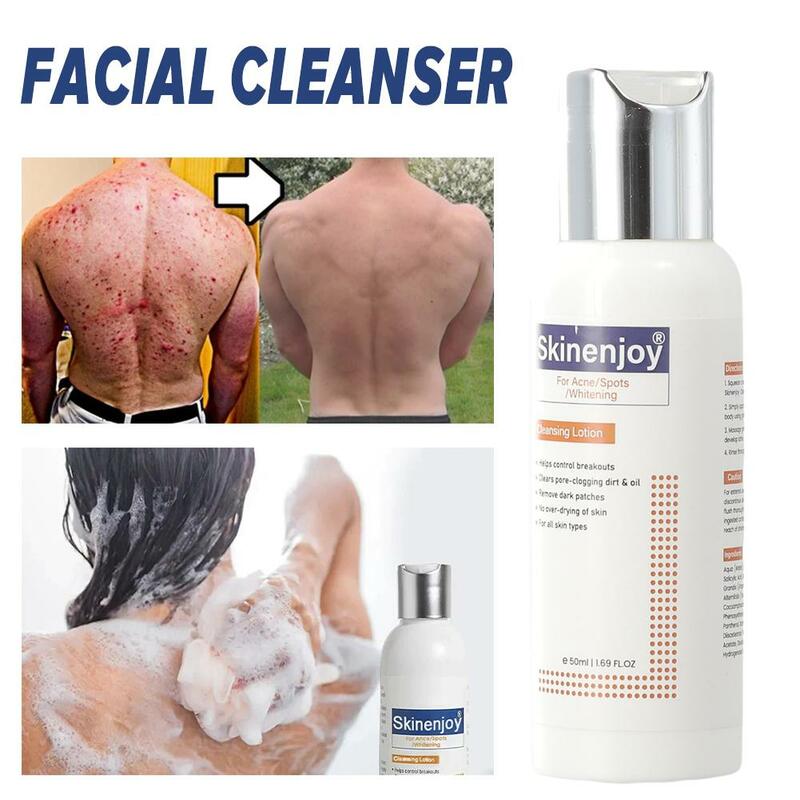 Limpiador Facial de espuma para el cuidado de la piel, limpiador Facial hidratante para eliminar puntos negros, reducir los poros, Limpieza Profunda, Control de aceite, blanqueamiento