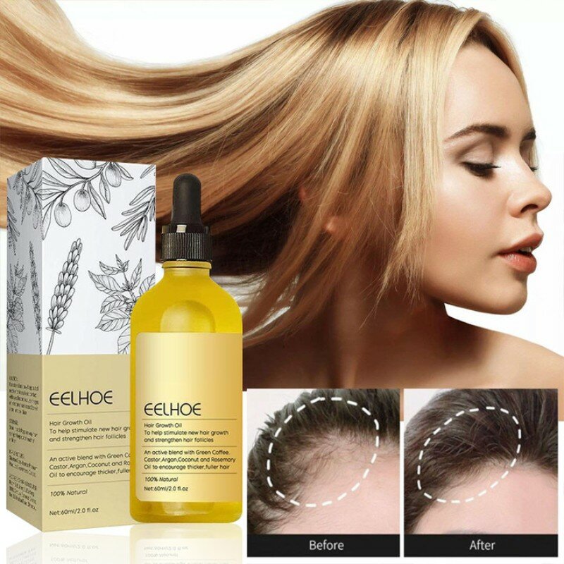 Minyak rambut alami, penumbuh efisien Anti rambut rontok menutrisi minyak esensial untuk perbaikan padat rambut rusak halus kesehatan kecantikan